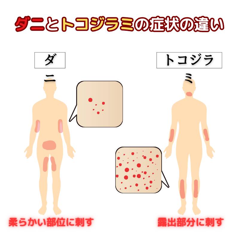 ダニとトコジラミの刺される場所の違いのイラスト